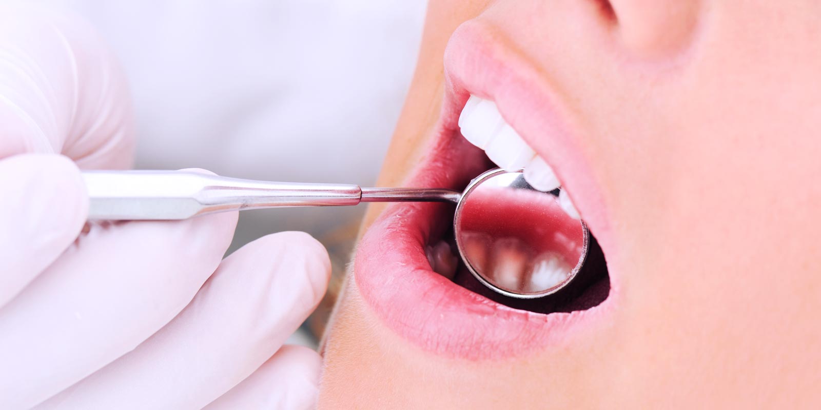 studio-dentistico-dottor-gola-casteggio-odontoiatria-pavia-dentista-implantologia-ortodonzia-protesi-chirurgia-91