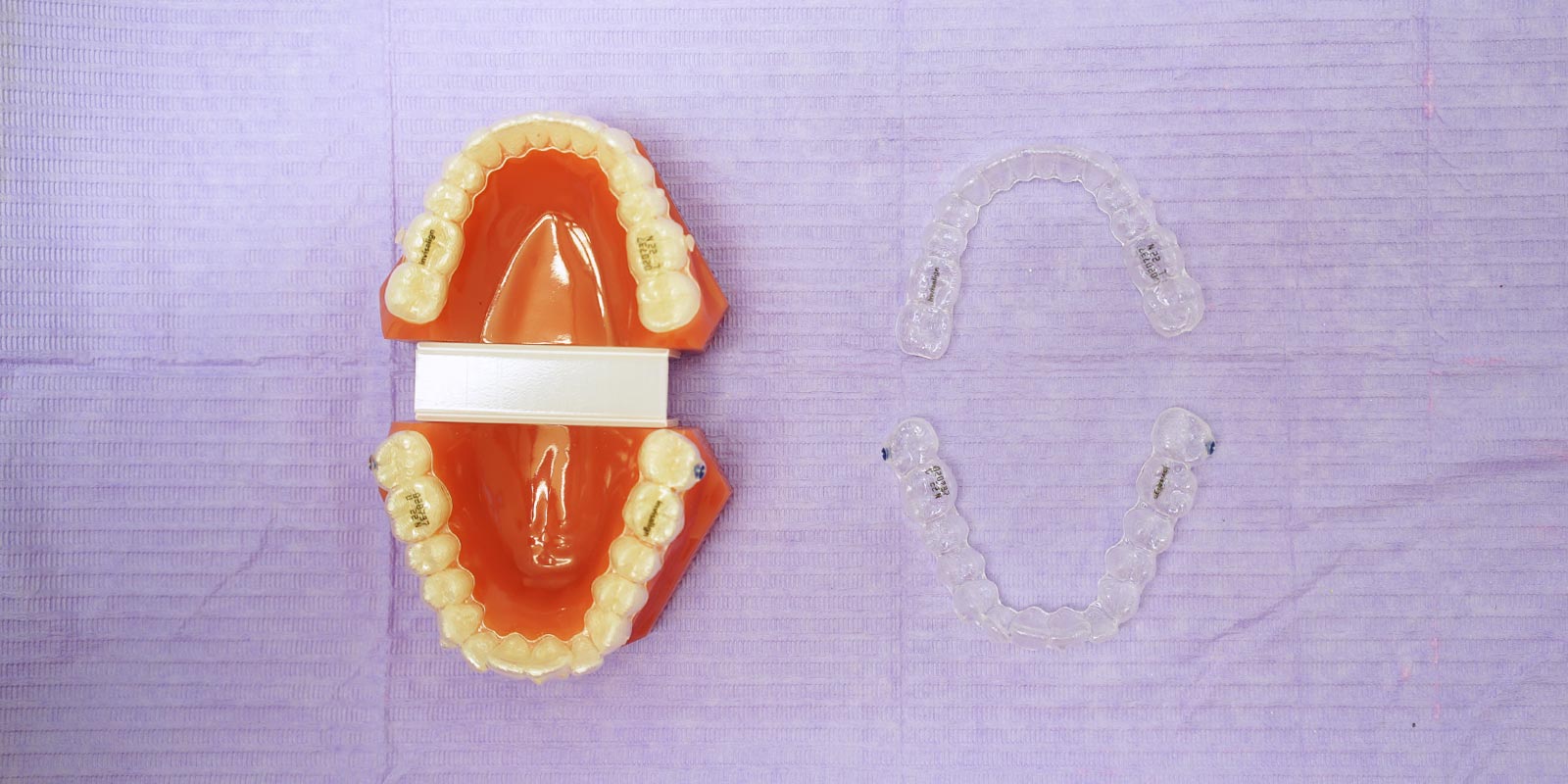 studio-dentistico-dottor-gola-casteggio-odontoiatria-pavia-dentista-implantologia-ortodonzia-protesi-chirurgia-95
