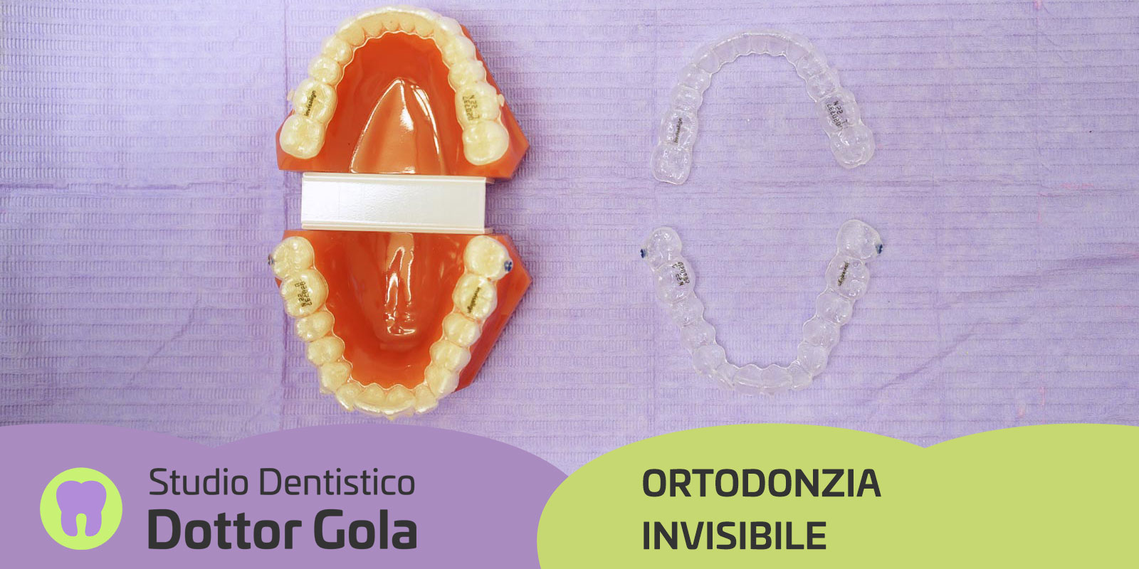ortodonzia-invisibile-dentista-gola-casteggio-pavia