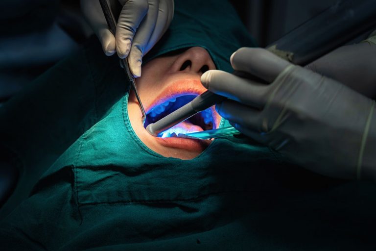 RIGENERAZIONE IN SEGUITO A LESIONE OSSEA CAUSATA DA PERIMPLANTITE CON