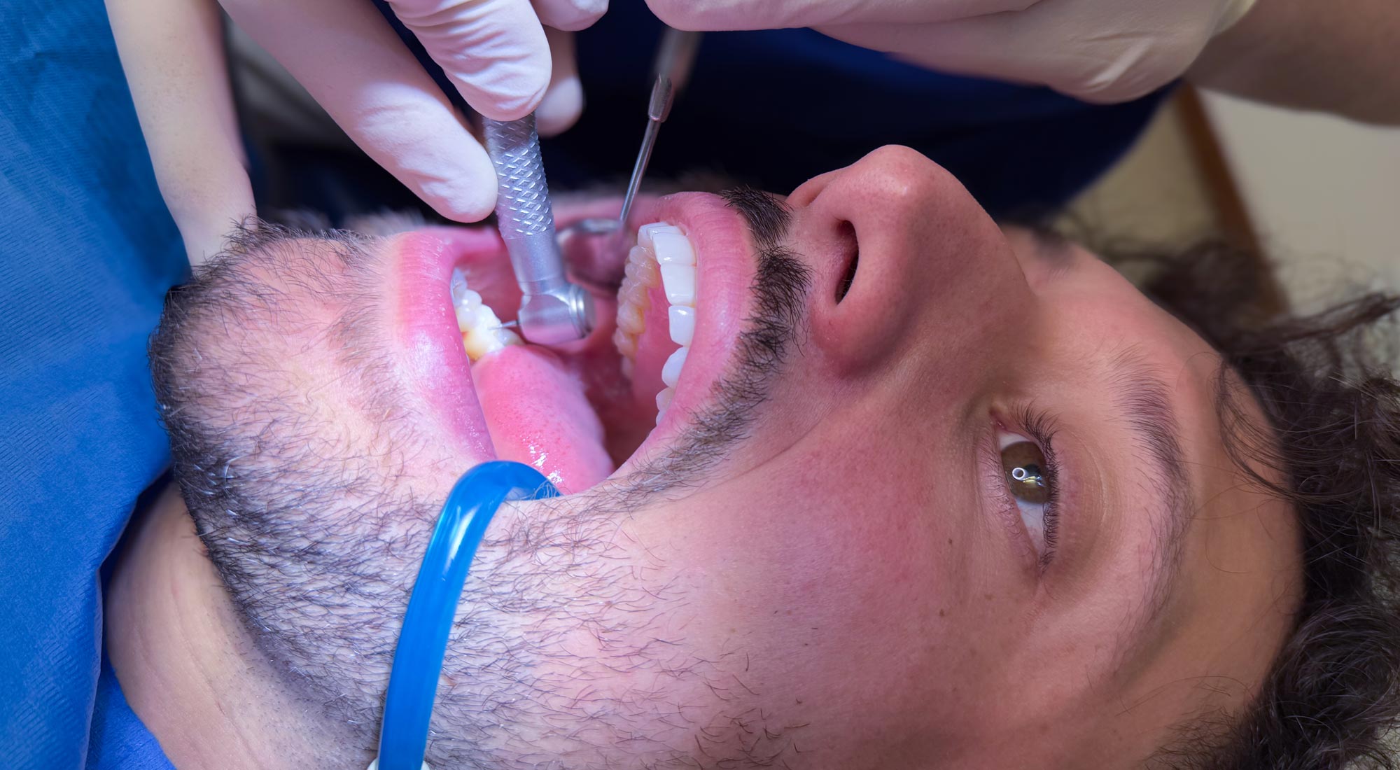 studio-dentistico-dottor-gola-casteggio-odontoiatria-pavia-dentista-implantologia-ortodonzia-protesi-chirurgia-332
