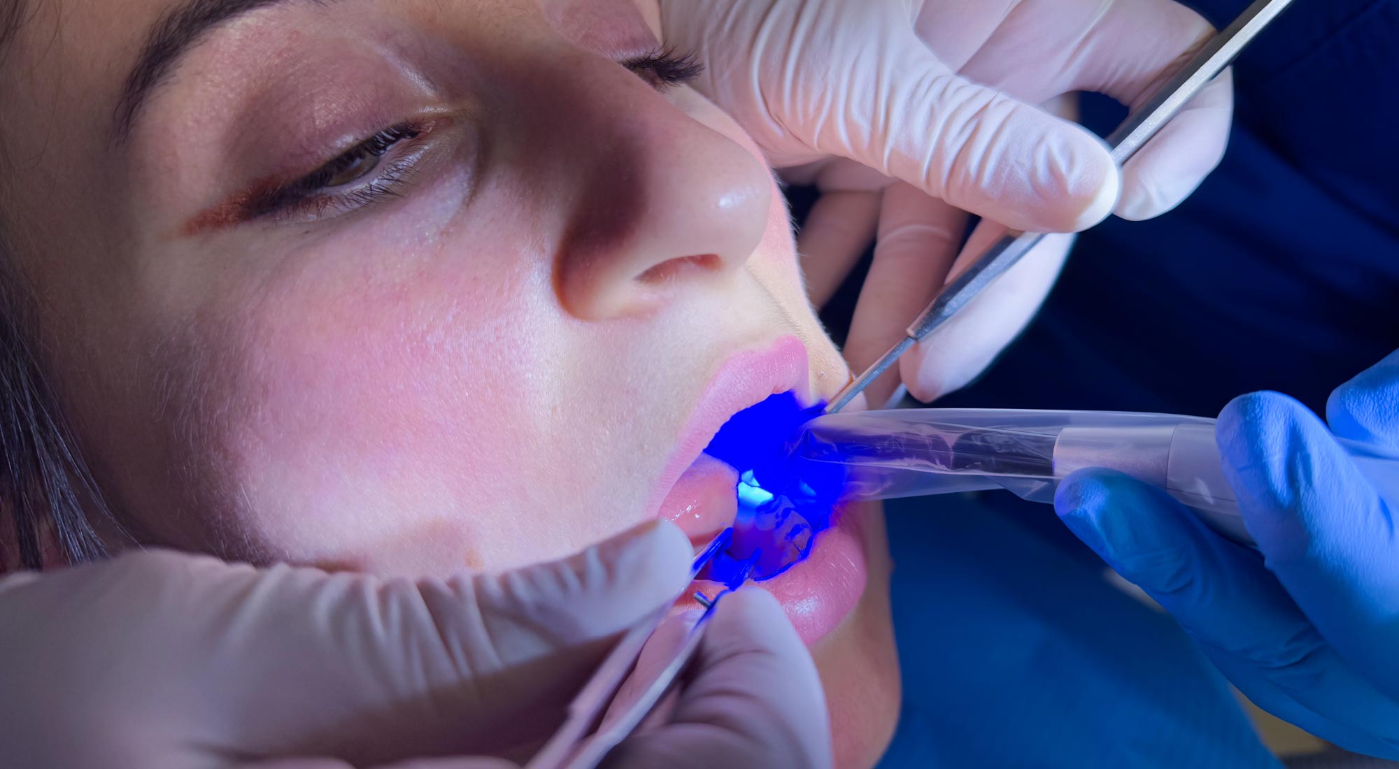 studio-dentistico-dottor-gola-casteggio-odontoiatria-pavia-dentista-implantologia-ortodonzia-protesi-chirurgia-353